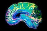 Functional MRI scan of the brain