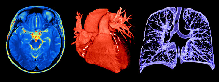 Imaging: brain, heart, and lung